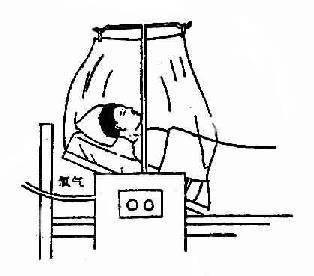 常见的氧疗吸氧方式有哪几种