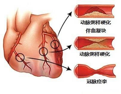 这6种方法能预防心血管疾病 你知道吗 健康频道 手机搜狐