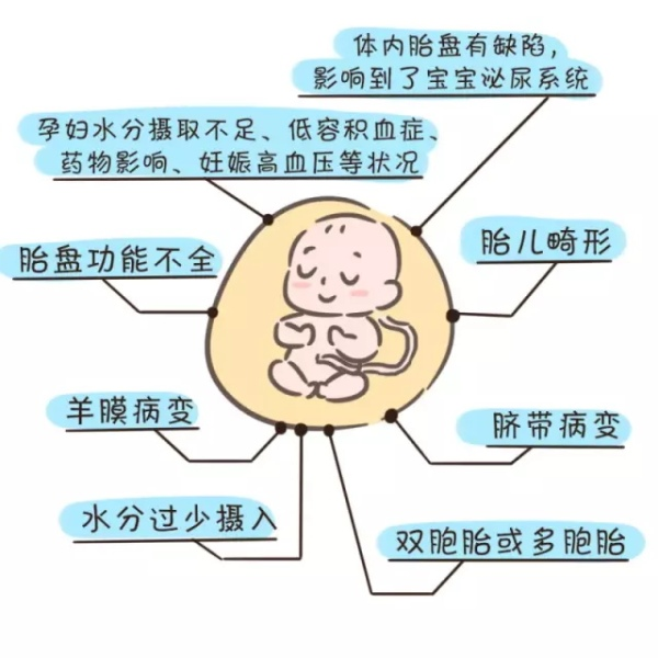 关乎宝宝健康的羊水,让专业医生解答最常见的疑问