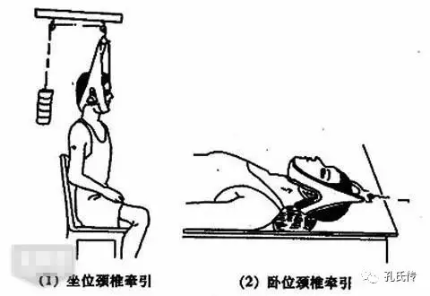 颈椎病患者必看 颈椎牵引的利与弊 健康频道 手机搜狐