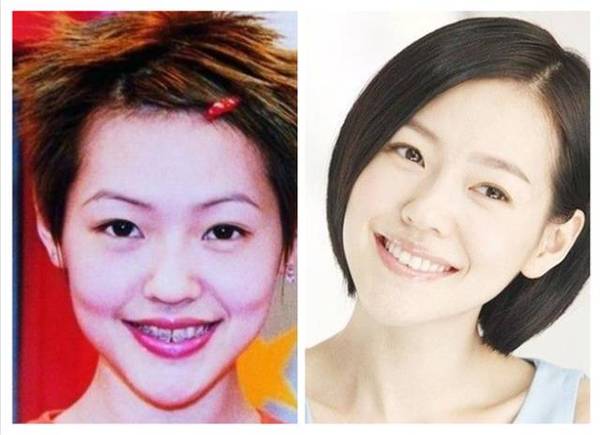 小s,阿雅,萧敬腾 孙杨,董璇,高圆圆 这些女神,泳神,雨神全都整了牙!