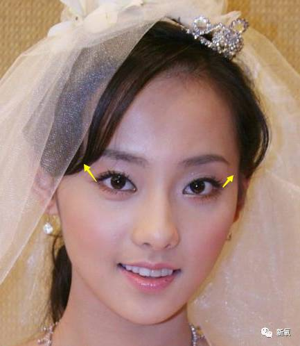 张嘉倪生完孩子比鲁豫还瘦!脸也是撞脸半个娱乐圈