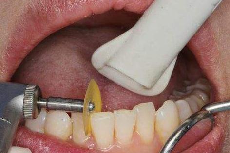 齐鲁德比来袭！刘维伟剑指复仇邱彪金身不保无杨瀚森更可怕？