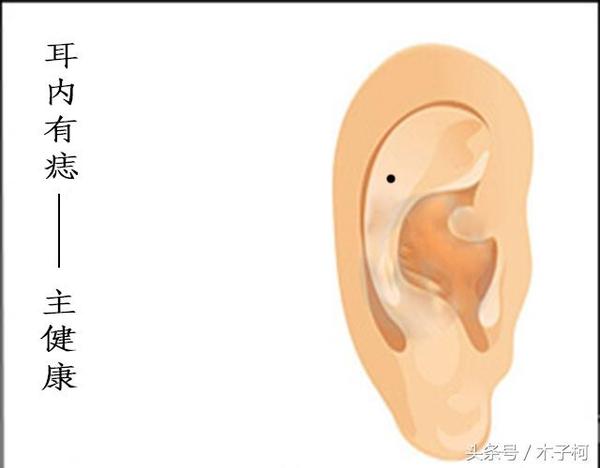 深度为你解剖 在耳朵长痣的好坏之处 星座频道 手机搜狐