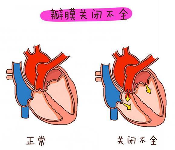 心脏瓣膜位置图片