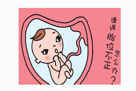 专门讲述了中医治疗产妇胎位不正的办法—艾灸至阴穴矫正胎位