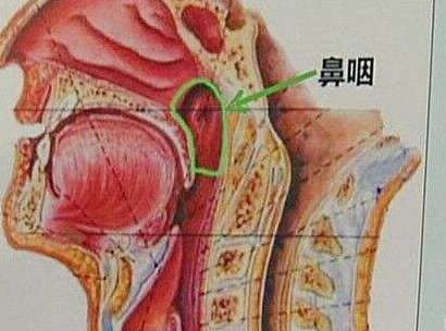 很少见鼻咽癌做手术 原因是这种治疗方法实在太强 健康频道 手机搜狐