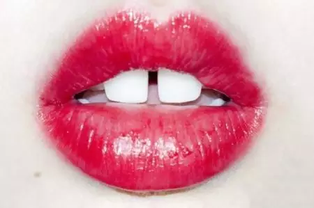 牙缝太大会漏财,可有方法补救?