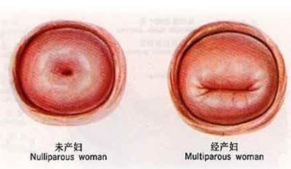 女人是否生过孩子,差别在哪里!看下面一眼就懂了